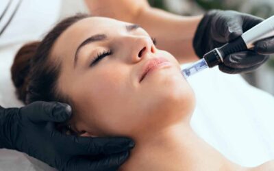 The Benefits of RF Microneedling With Morpheus8