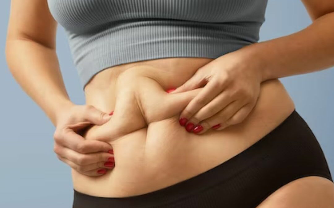 How to Get Rid of Stubborn Fat: A Guide to Non-Invasive Fat Reduction Treatments